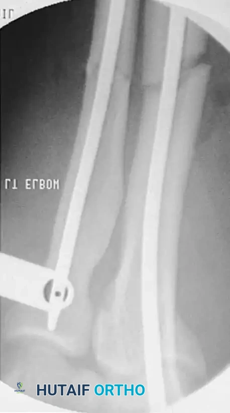 Hutaifortho's Orthopaedic Diagram