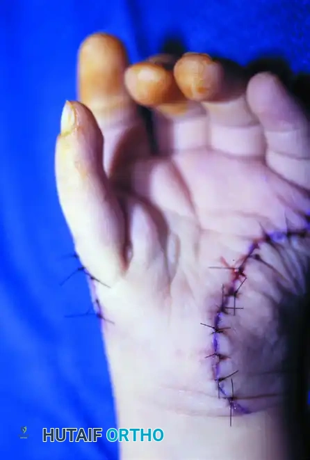 Postoperative Appearance