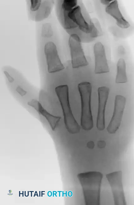 Radiographic Appearance