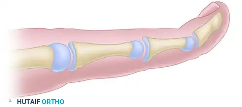 RECONSTRUCTION OF THE HAND AND WRIST Surgical Diagram