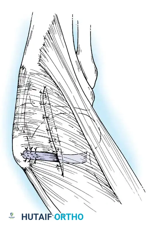 Hutaifortho's Orthopaedic Diagram