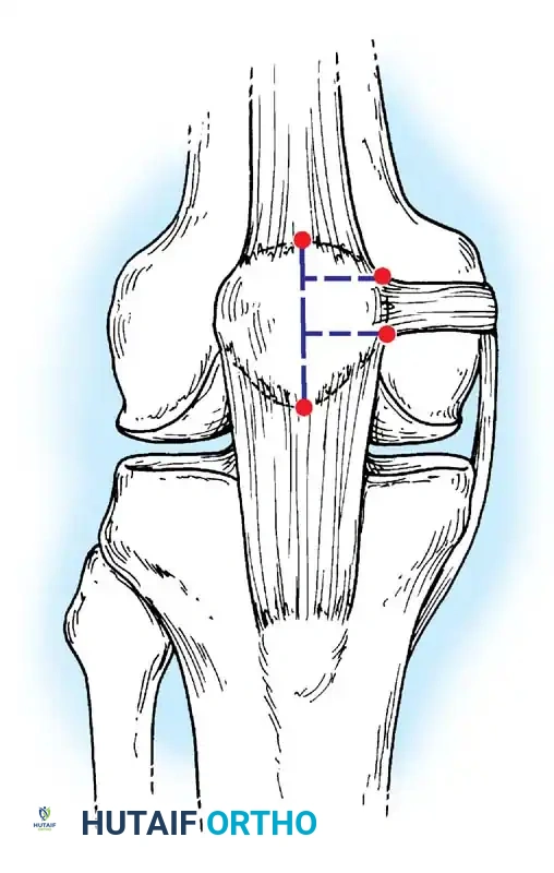 Hutaifortho's Orthopaedic Diagram
