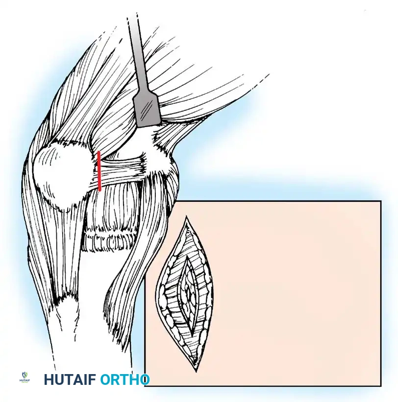 Hutaifortho's Orthopaedic Diagram
