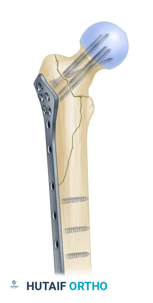 Hutaifortho's Orthopaedic Diagram