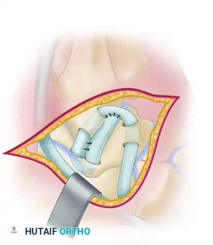 Hutaifortho's Orthopaedic Diagram