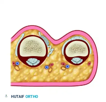 Traumatic Extensor Tendon Dislocation Repair Guide