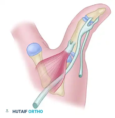 Surgical Management of Thumb Hypoplasia and Aplasia: Advanced Reconstructive Techniques