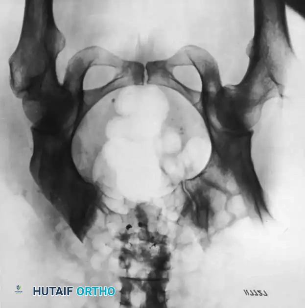 Hutaifortho's Orthopaedic Diagram