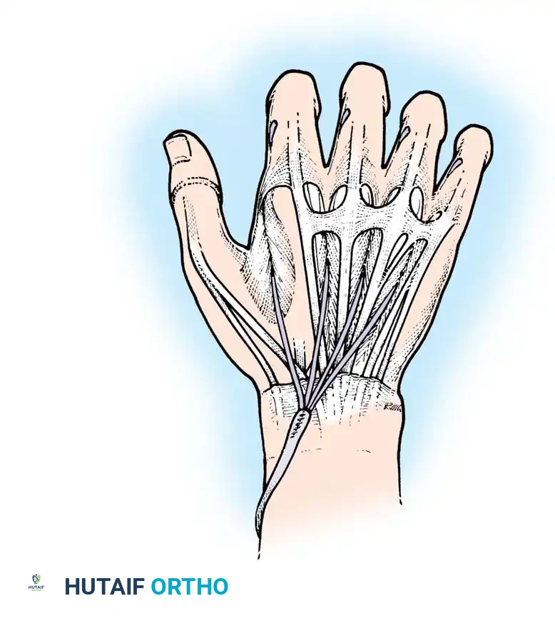 Four-tailed plantaris tendon graft sutured to tendon of flexor carpi radialis muscle