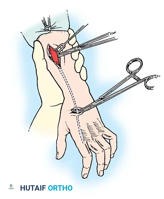 Hutaifortho's Orthopaedic Diagram