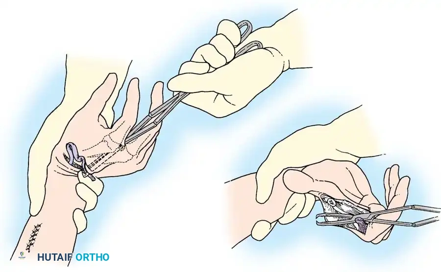 Hutaifortho's Orthopaedic Diagram