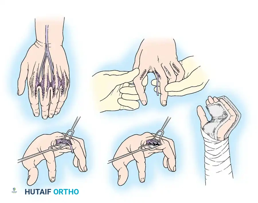 Hutaifortho's Orthopaedic Diagram