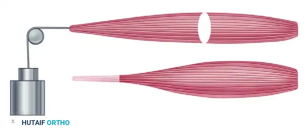 Surgical Restoration of Pinch and Thumb Opposition
