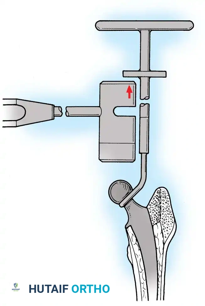Hutaifortho's Orthopaedic Diagram