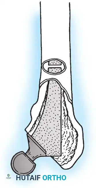 Hutaifortho's Orthopaedic Diagram