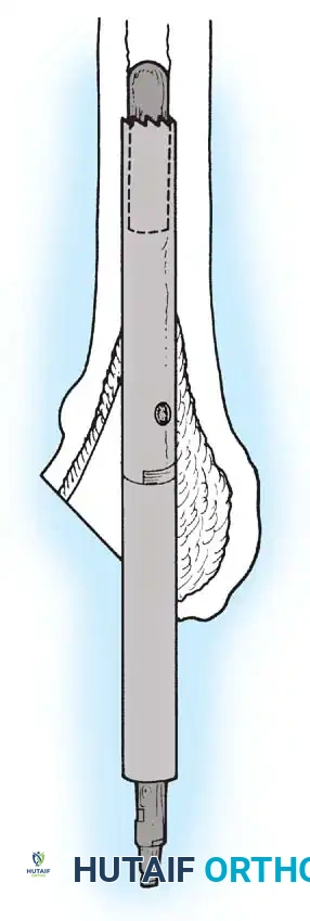 Hutaifortho's Orthopaedic Diagram