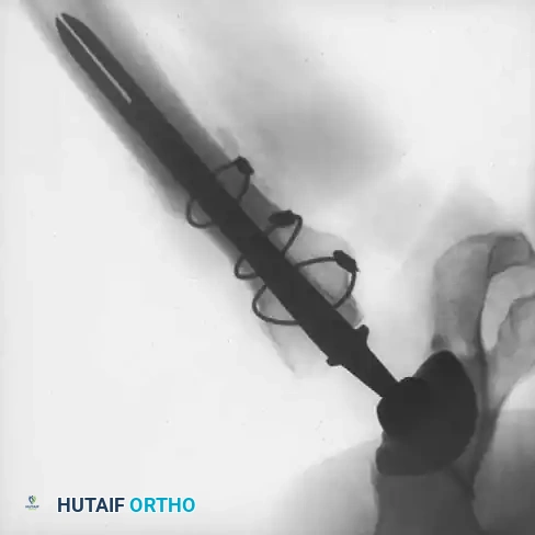 Hutaifortho's Orthopaedic Diagram