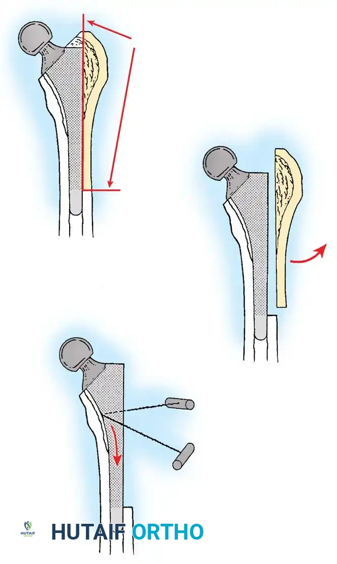 Hutaifortho's Orthopaedic Diagram