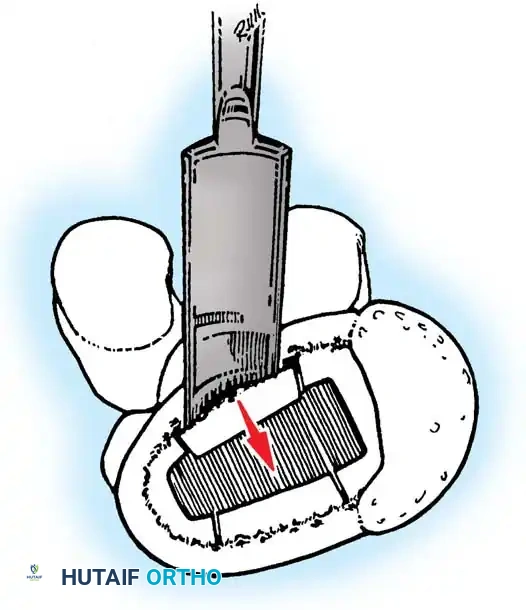 Hutaifortho's Orthopaedic Diagram