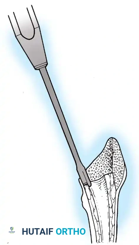 Hutaifortho's Orthopaedic Diagram