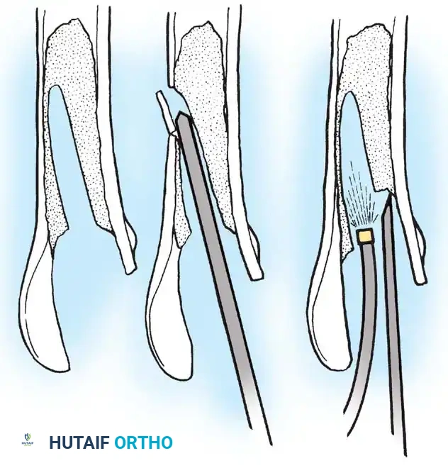 Hutaifortho's Orthopaedic Diagram