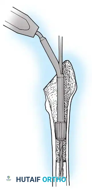 Hutaifortho's Orthopaedic Diagram
