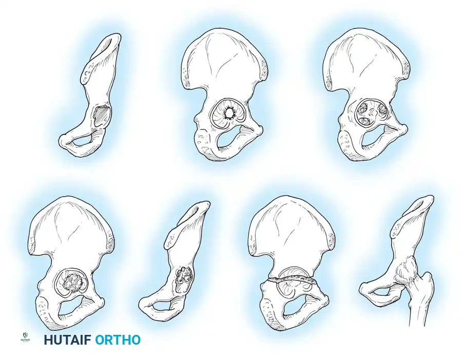 Hutaifortho's Orthopaedic Diagram