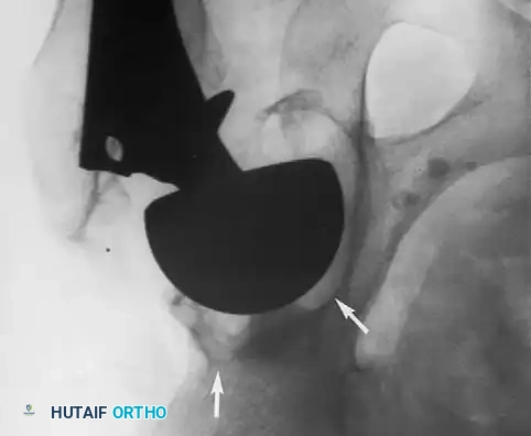 Hutaifortho's Orthopaedic Diagram