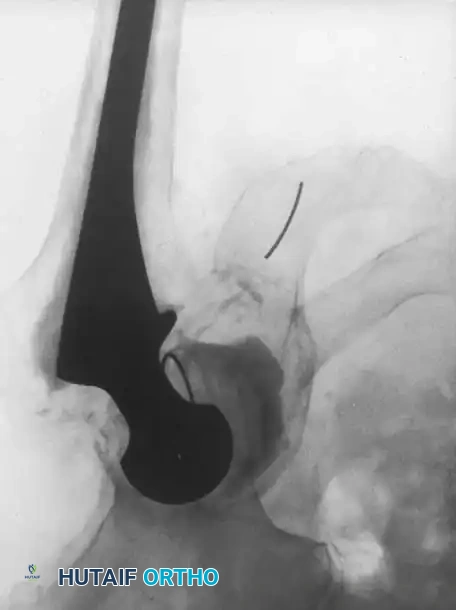 Hutaifortho's Orthopaedic Diagram