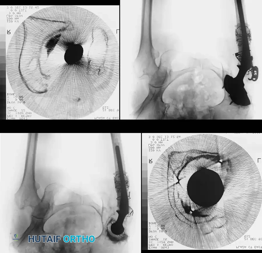 Hutaifortho's Orthopaedic Diagram