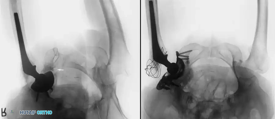 Hutaifortho's Orthopaedic Diagram