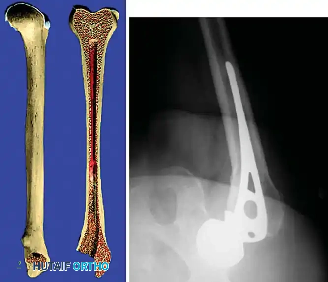 Hutaifortho's Orthopaedic Diagram