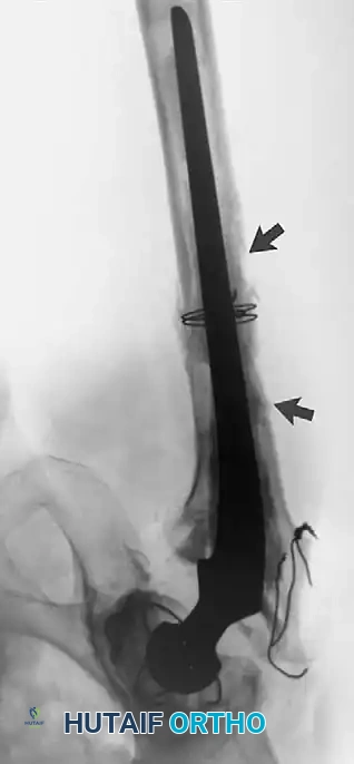 Hutaifortho's Orthopaedic Diagram