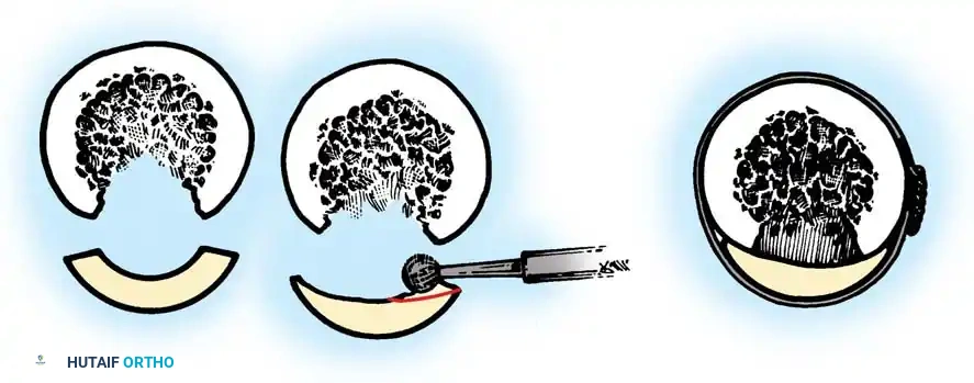 Hutaifortho's Orthopaedic Diagram