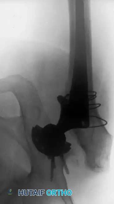 Hutaifortho's Orthopaedic Diagram