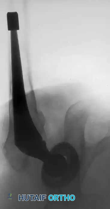 Hutaifortho's Orthopaedic Diagram