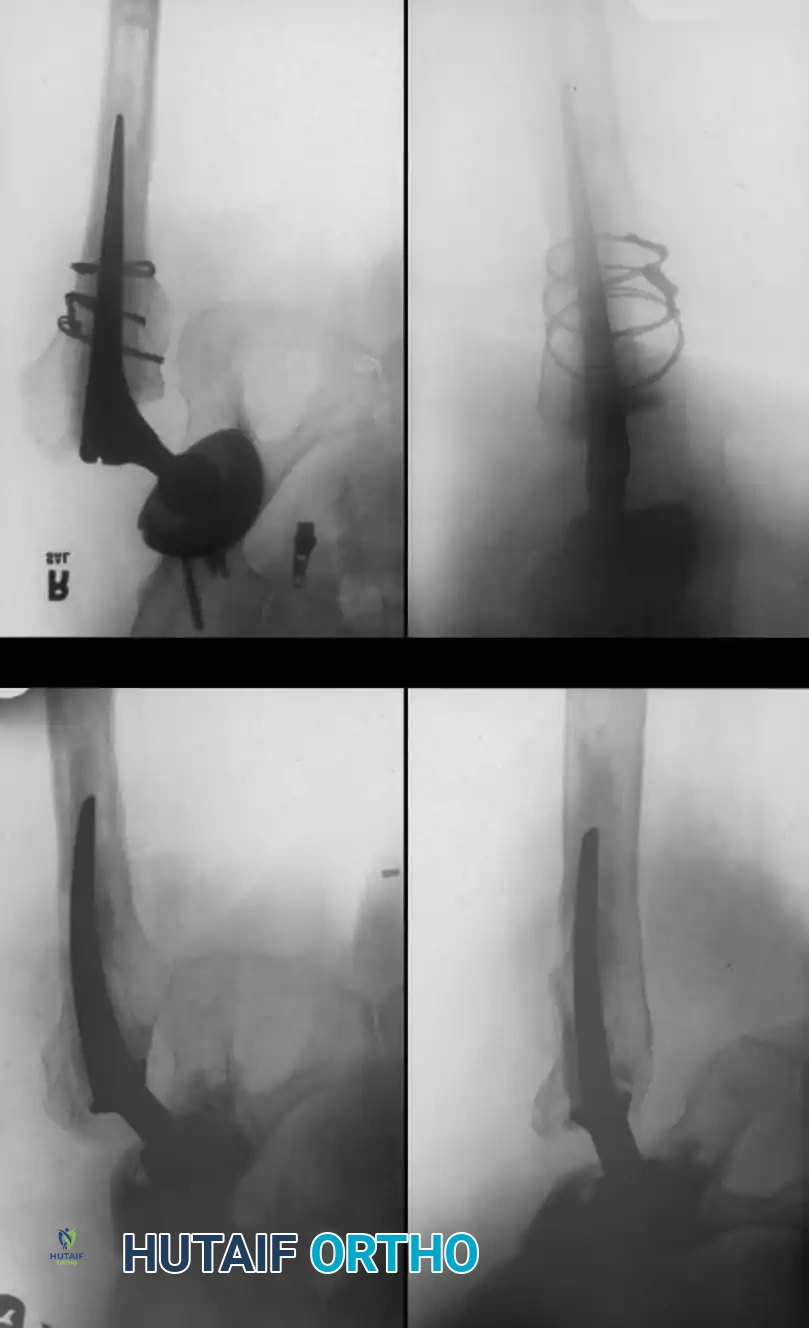 Hutaifortho's Orthopaedic Diagram