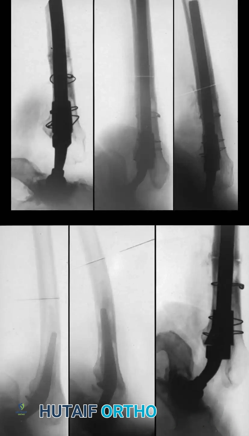 Hutaifortho's Orthopaedic Diagram
