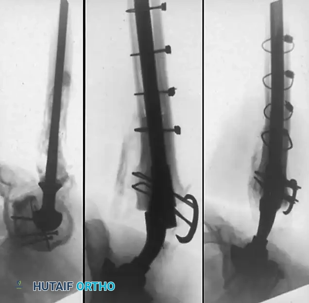 Hutaifortho's Orthopaedic Diagram