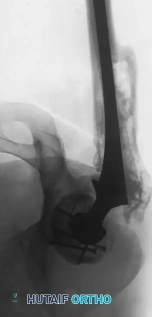 Hutaifortho's Orthopaedic Diagram