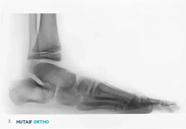 Hutaifortho's Orthopaedic Diagram