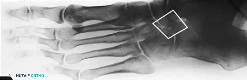 Hutaifortho's Orthopaedic Diagram