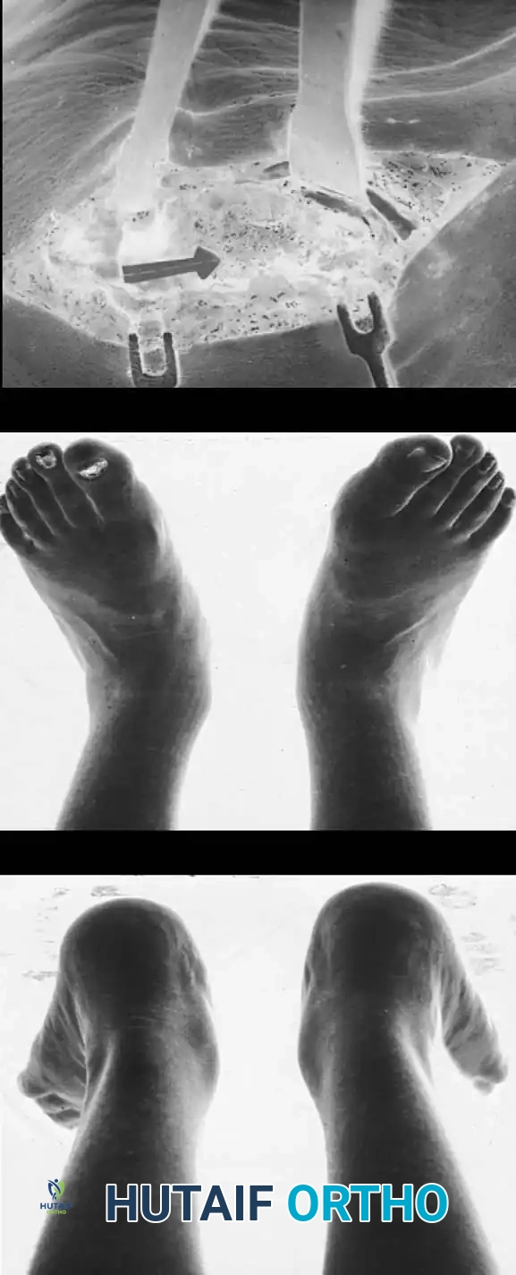 Hutaifortho's Orthopaedic Diagram