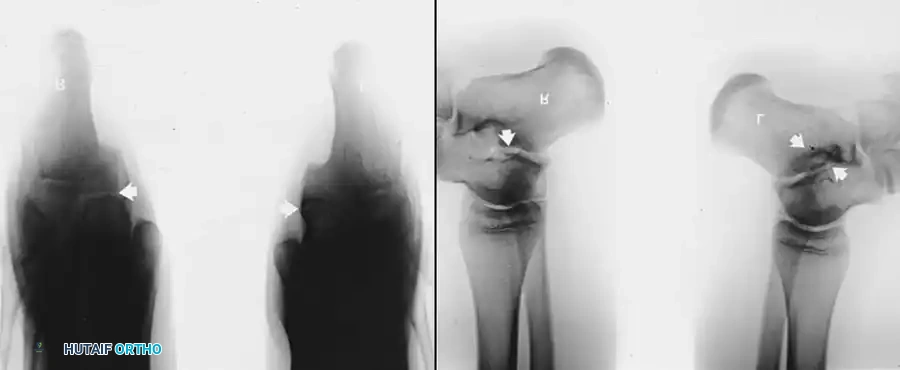 Hutaifortho's Orthopaedic Diagram