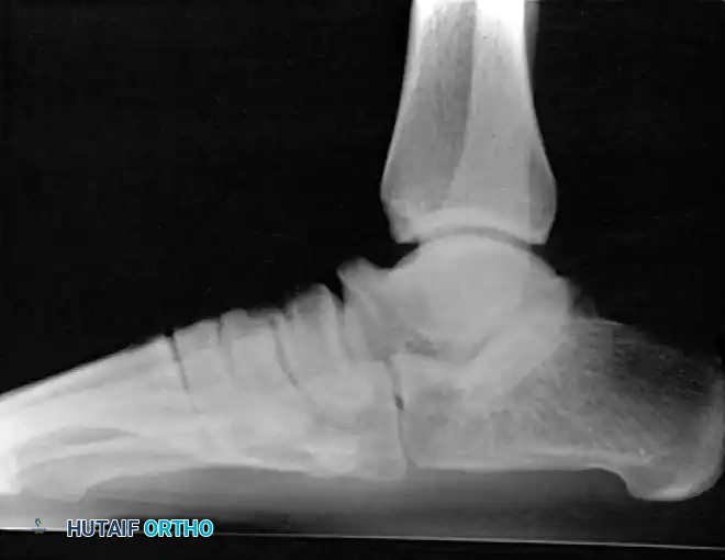 Hutaifortho's Orthopaedic Diagram