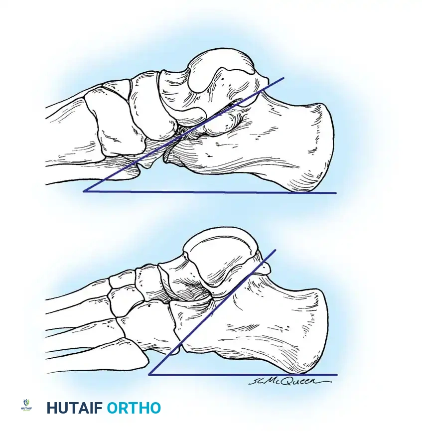Hutaifortho's Orthopaedic Diagram