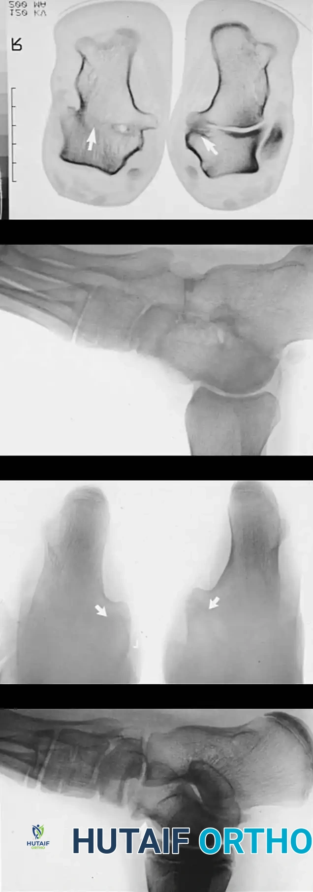 Hutaifortho's Orthopaedic Diagram