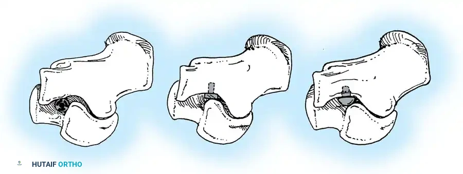 Hutaifortho's Orthopaedic Diagram