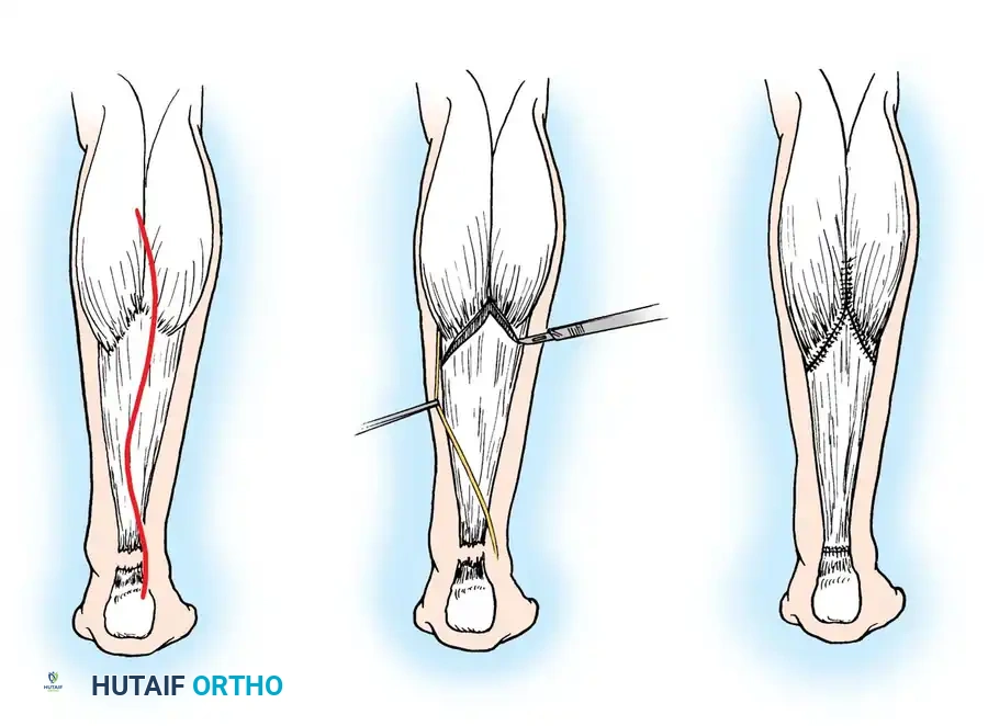 Hutaifortho's Orthopaedic Diagram