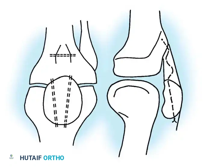 Hutaifortho's Orthopaedic Diagram